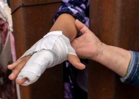 a bandaged hand sticking through the fence